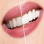 Teeth & Mouth Care