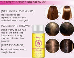 Herbal Hair Growth Anti Hair LossThick Fast Hair Growth Treatment 20ml Essential Oil Health