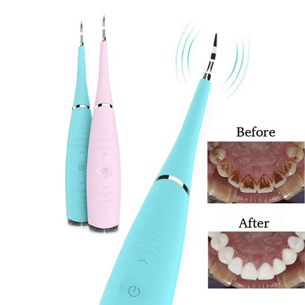 Teeth whitening Home Use Tooth Stain Remover Tartar Teeth Stains Scaling USB Charging High Frequency Vibration Dentist tools