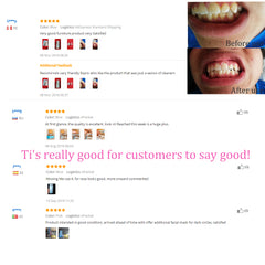 Teeth whitening Home Use Tooth Stain Remover Tartar Teeth Stains Scaling USB Charging High Frequency Vibration Dentist tools