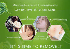 Treatment Face Cream Anti Acne Scar Removal Pimple Blackhead Moisturizing Whiten Oil-control Shrink Pores Skin Care